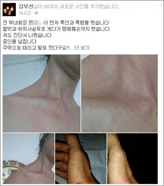 배우 김부선이 페이스북에 부녀회로부터 폭행을 당한 사진과 글을 올려 억울함을 호소했다.ⓒ김부선 페이스북 사진 캡처