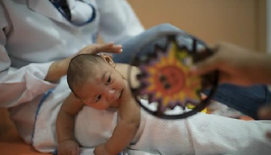 브라질의 소두증 아기. ⓒ연합뉴스