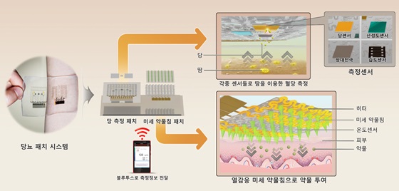 그래핀 전자피부(당뇨패치) 구현 시스템.ⓒ미래창조과학부