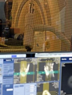 서울의 한 병원에서 자기공명영상(MRI) 촬영이 진행되고 있는 모습.ⓒEBN
