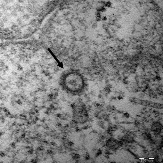 코로나19 바이러스(SARS-CoV-2)의 전자현미경 사진. ⓒ질병관리본부