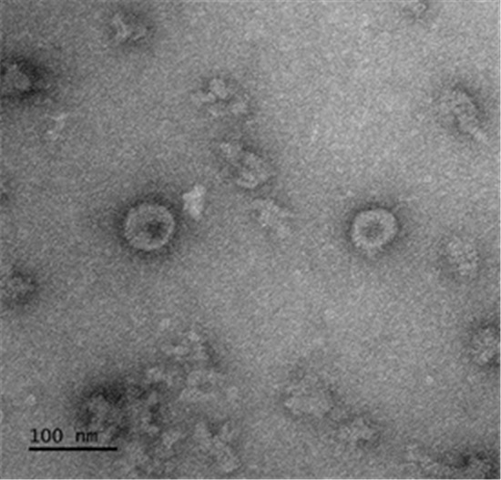코로나19 바이러스항원(Spike)으로 구성된 바이러스유사체 투과전자현미경 (TEM) 이미지.ⓒ국립보건연구원