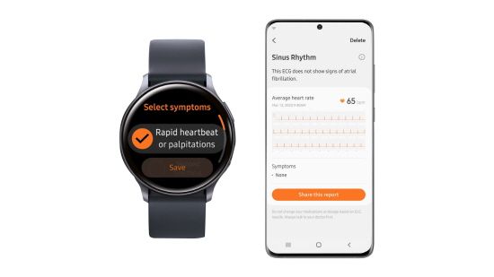 삼성 헬스 모니터 앱과 갤럭시 워치 액티브2를 통해 심전도를 측정할 수 있다ⓒ삼성전자