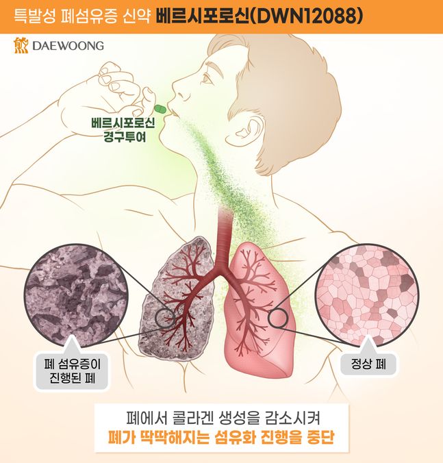 대웅제약 베르시포로신(DWN12088) 작용 기전. [제공=대웅제약]